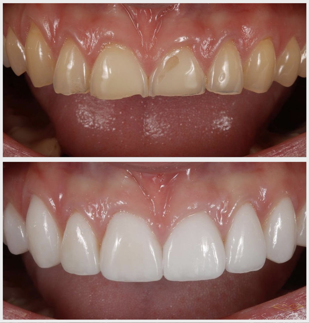 Cosmetic Portfolio -Tijuana Clinic For Cosmetic Dentistry